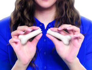 پوکی استخوان